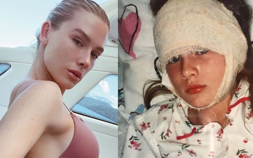 Fiorella Mattheis Revela Que Operou Orelhas De Abano Aos 9 Anos Quem Quem News You will find below the horoscope of fiorella mattheis with her interactive chart, an excerpt of her astrological portrait and her planetary dominants. fiorella mattheis revela que operou