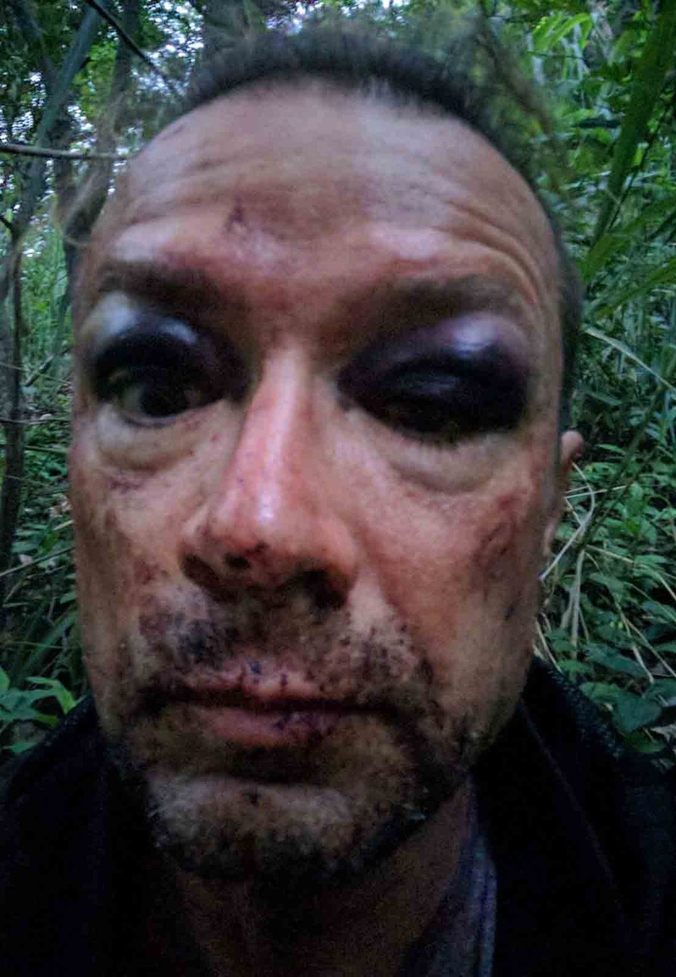  Thomas Antallfy tirou self após ter ficado horas desacordado por causa de uma queda de paraglider. (Foto: Thomas Antallfy / Arquivo pessoal )