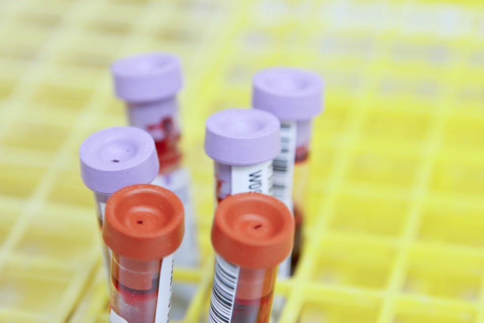 Laboratórios, como os que fazem exame de sangue, se queixam de demora no pagamento — Foto: Unsplash