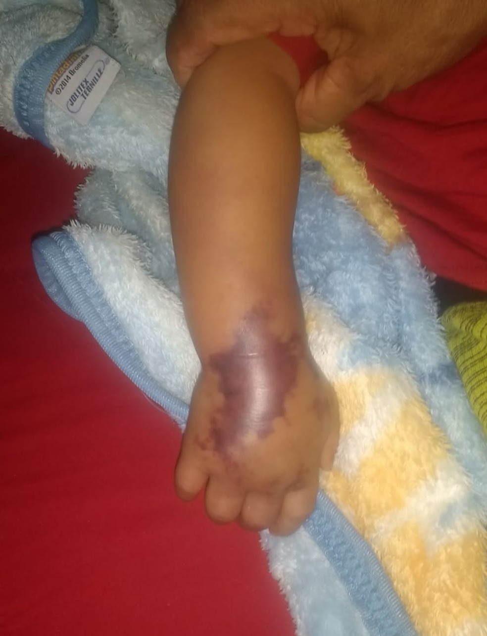 Hospital de Barras abre sindicância para investigar morte de bebê de 11 meses — Foto: Reprodução