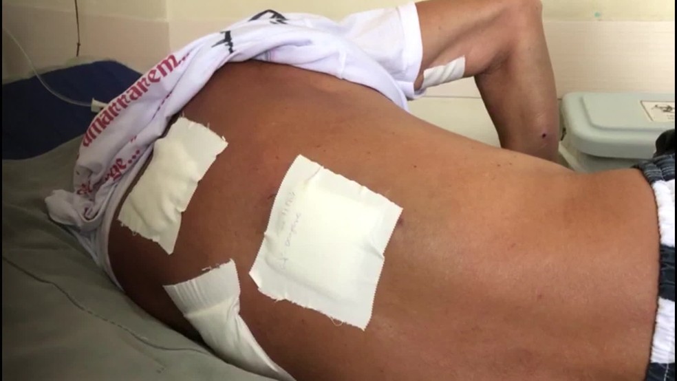 Sérgio ficou com vários ferimentos após os disparos do Exército — Foto: Reprodução/TV Globo