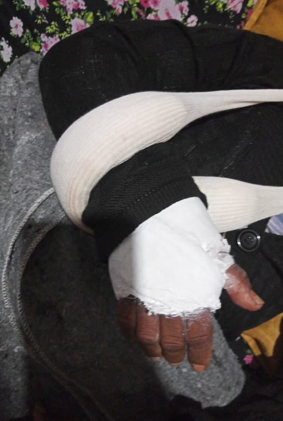 Mulher sofreu ferimentos nos braços e no rosto após as agressões  — Foto: Arquivo pessoal 