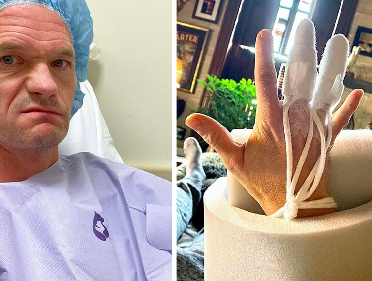 O ator Neil Patrick Harris passou por uma cirurgia na mão após sofrer um acidente envolvendo um ouriço-do-mar na Croácia (Foto: Instagram)