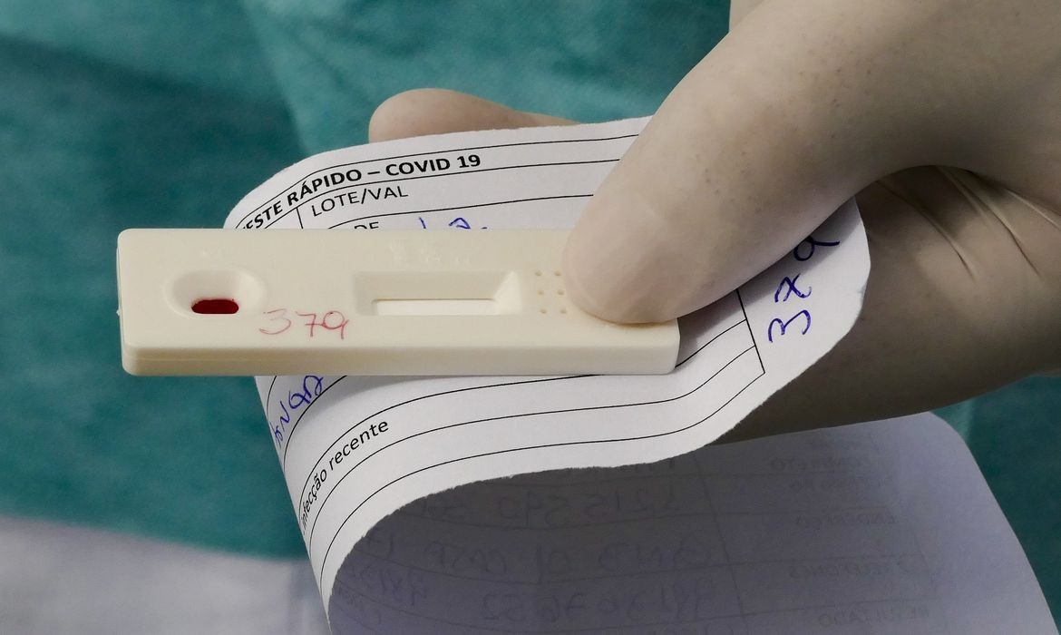 Anvisa aprova novo teste de diagnóstico para covid-19 (Foto: Leopoldo Silva/Agência Senado)