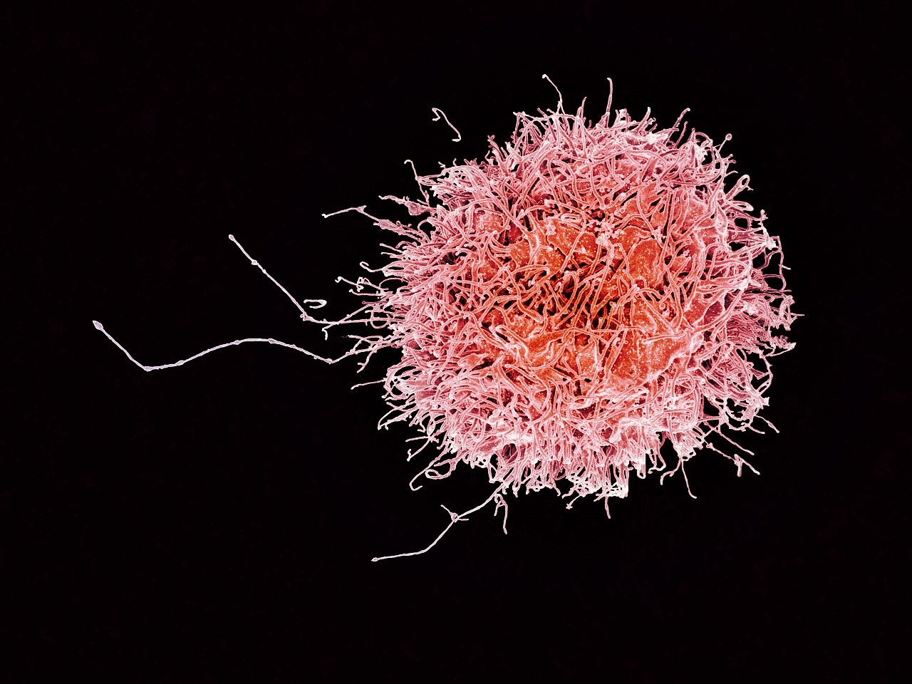 Quando as células natural killers (foto) são acionadas corretamente, conseguem reconhecer e destruir células infectadas, impedindo que a doença se instale no organismo (Foto: NIAID)
