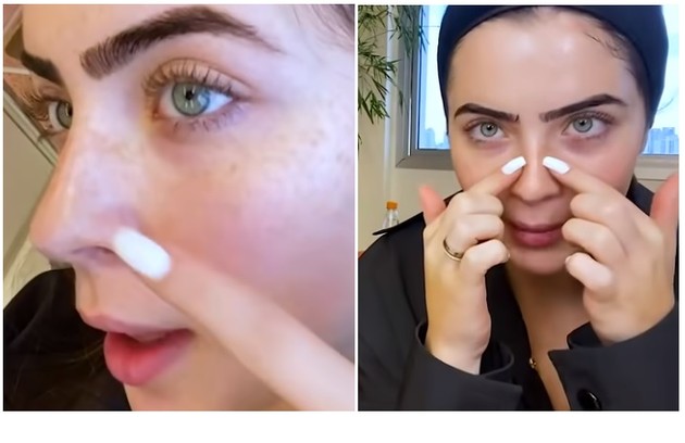 Jade Picon Jade, de 20 anos, fez diversos procedimentos no rosto. Um deles é um método que poupa colágeno. Outro é um tratamento a laser para diminuir as sardas (Foto: Reprodução)