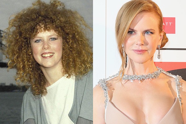 Olhando para as fotos, não parecem duas pessoas diferentes? Acredite se quiser, mas é a atriz Nicole Kidman quem se encontra nas duas imagens. Os boatos são de que a diva passou por procedimentos no rosto e nos seios. (Foto: Getty Images)
