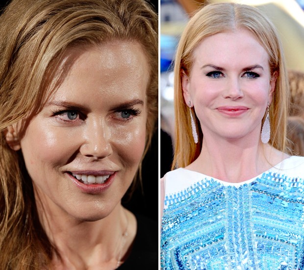Foco no rosto de Kidman em diferentes anos, em 2013 e 2012 (Foto: Getty Images)