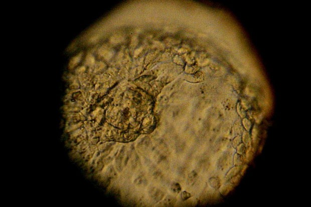 Embrião (Foto: Getty Images)