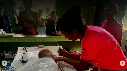 36% das crianças Yanomami têm déficit de peso, revela Ministério da Saúde