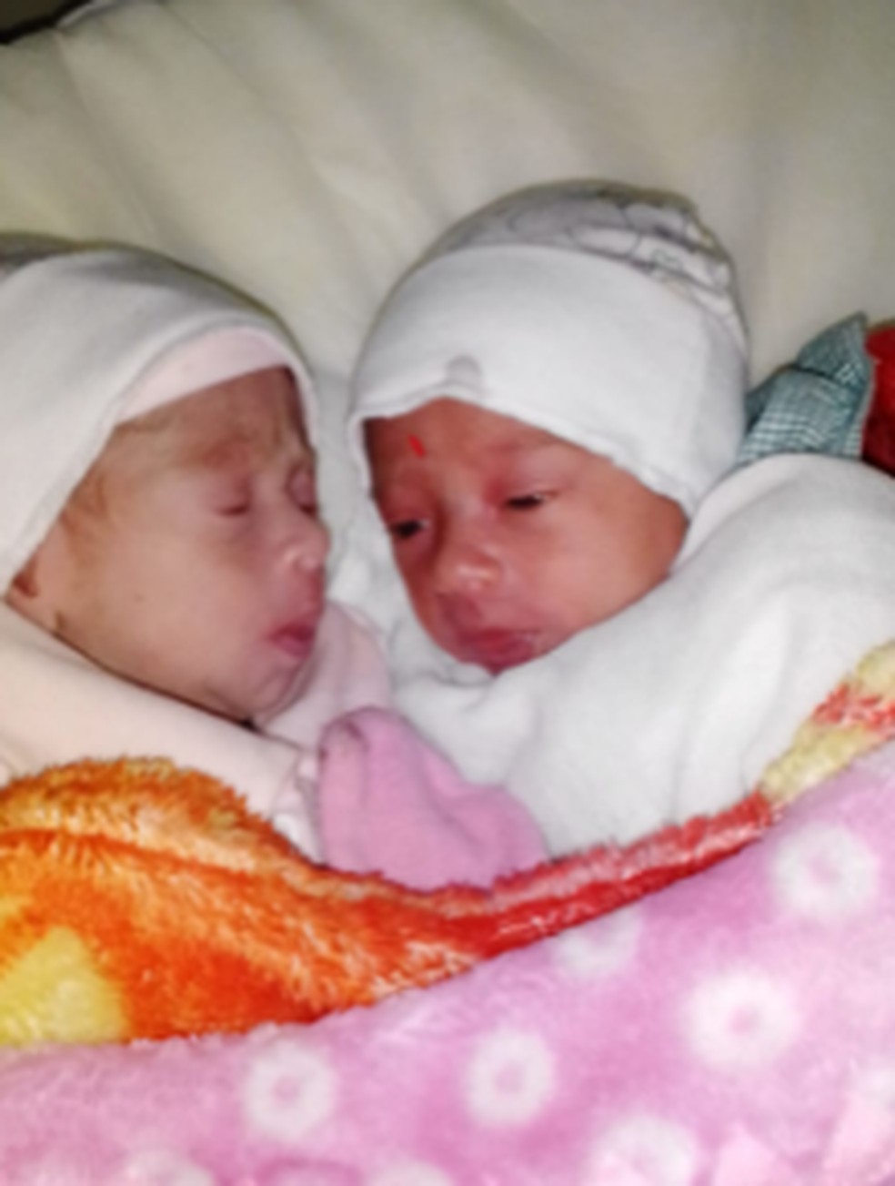 Maiara e Maraísa nasceram no dia 2 de julho em hospital de Rio Branco — Foto: Arquivo pessoal