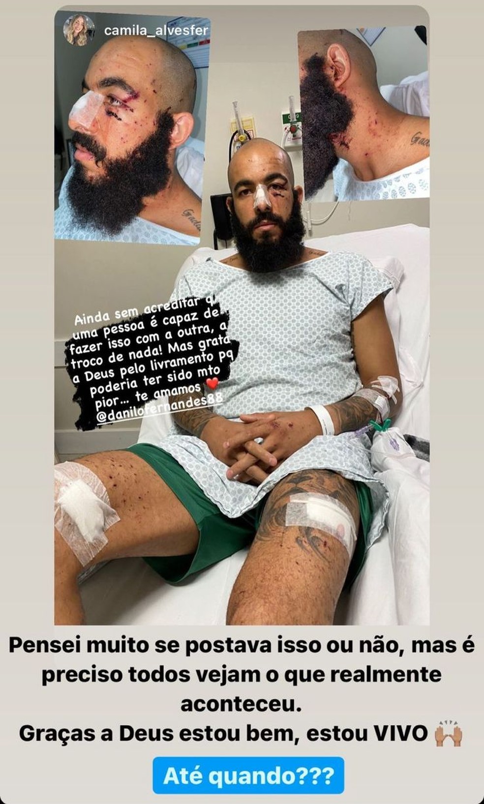 Danilo Fernandes ficou ferido após ataque ao ônibus do Bahia — Foto: Reprodução / Redes Sociais