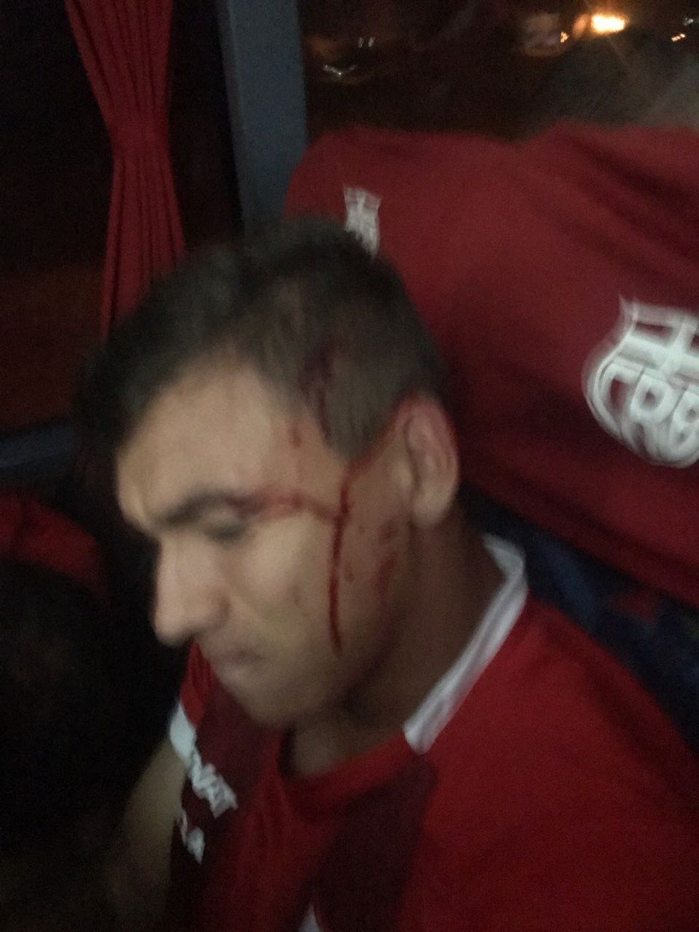 Atacante Ruan sofeu cortes na cabeça  (Foto: Roberto Boroni/ Assessoria CRB)