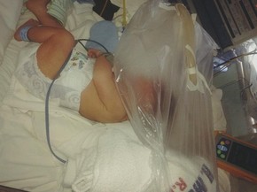 saco plástico, maternidade, bebê, Macapá, Amapá (Foto: Jorge Abreu/G1)