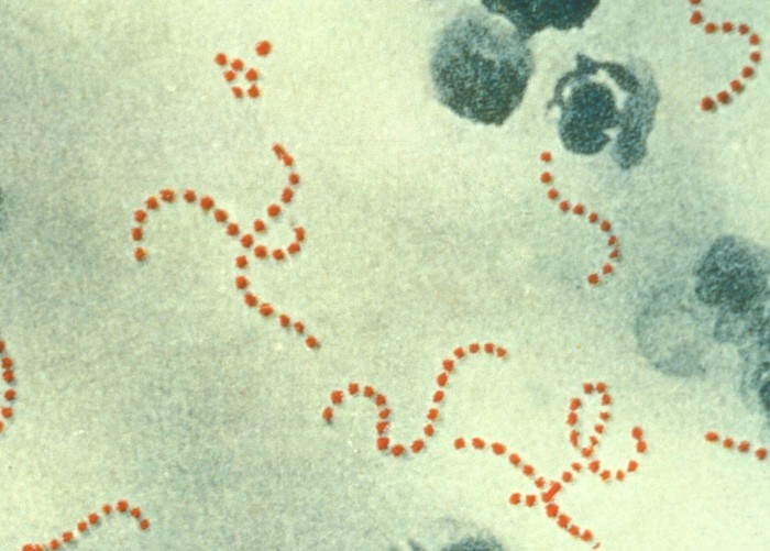 Bactéria do gênero Streptococcus (Foto: Wikimedia/Centers for Disease Control and Prevention's Public Health Image Library)