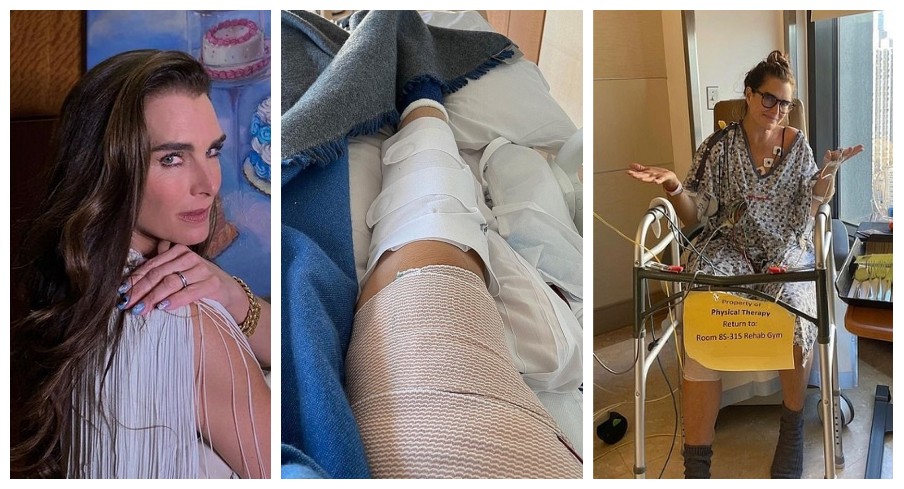 A atriz e modelo Brooke Shields precisou ser internada e passar por duas cirurgias após quebrar a perna (Foto: Instagram)