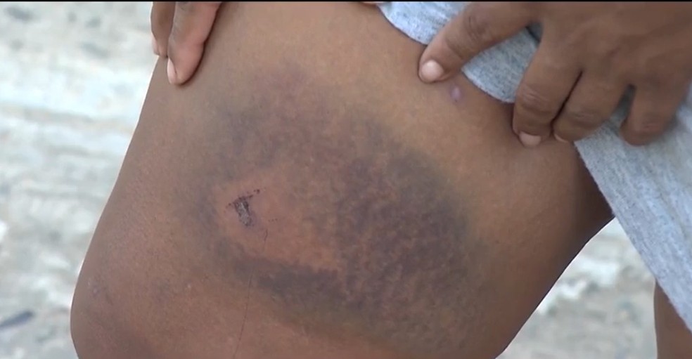 Vídeo mostra agressão de policiais com cassetetes em indígena durante festa na BA — Foto: Reprodução/TV Santa Cruz