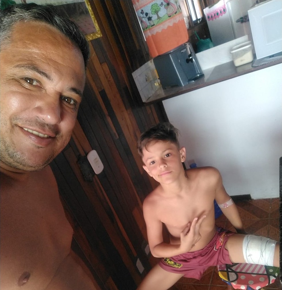 Pai e filho após incidente; ambos relataram que foi um alívio ferimento ter sido leve  — Foto: Arquivo Pessoal