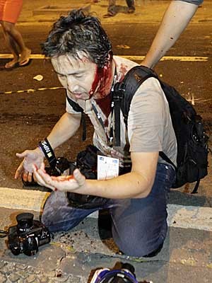 Yasuyoshi Chiba, logo após ser atingido na cabeça. (Foto: Uanderson Fernandes / AFP Photo)