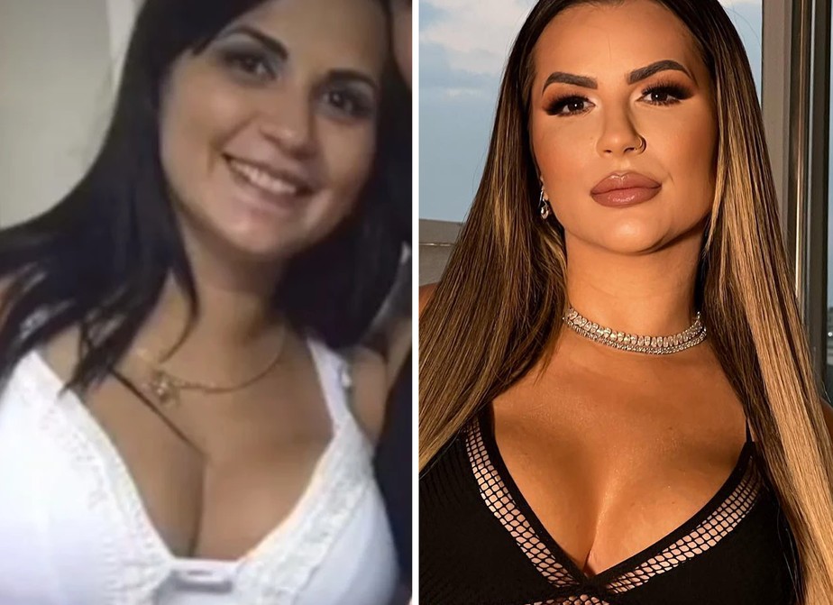 Deolane Bezerra: antes e depois de procedimentos