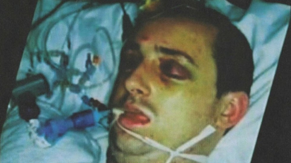 Paul Pugh ficou em coma por mais de dois meses após ser brutalmente espancado (Foto: Headway)