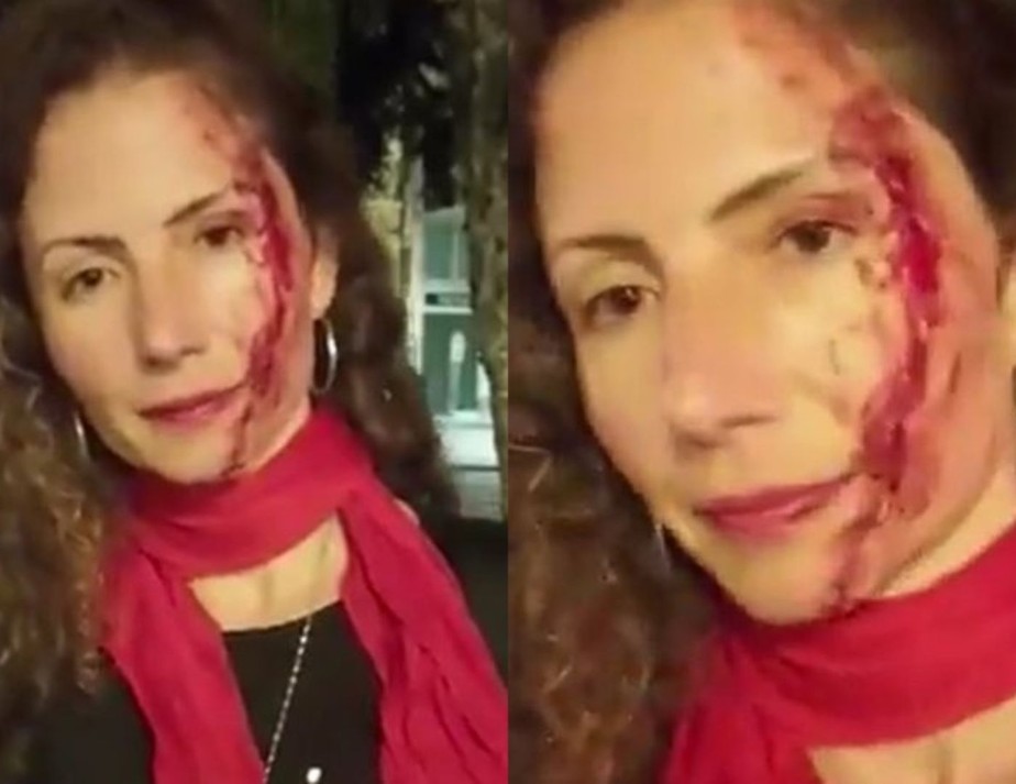 Jornalista Magalea Mazziotti mostrou rosto machucado após ataque em Curitiba; ela usava um adesivo com o rosto do candidato Lula