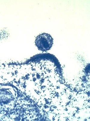HIV cresce em células imunes humanas, que o vírus infecta e usa para se replicar (Foto: NIAID/AP) HIV cresce em células imunes humanas, que o vírus infecta e usa para se replicar (Foto: NIAID/AP)