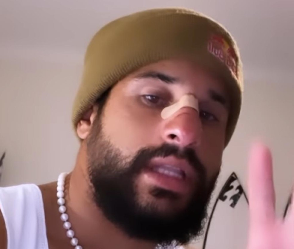 Italo Ferreira postou vídeo e mostrou como ficou o nariz — Foto: Reprodução