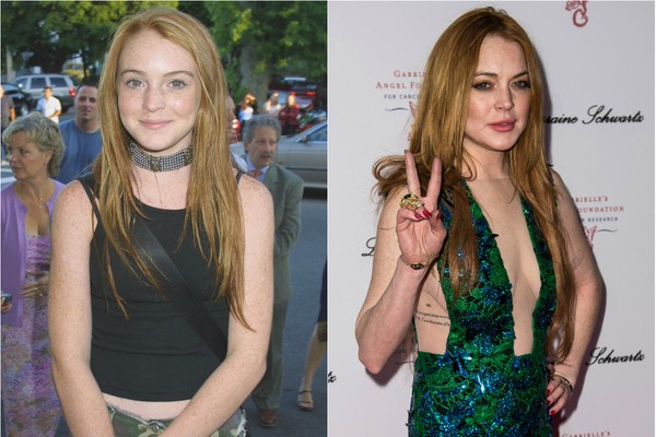  A transição para a vida adulta de Lindsay Lohan foi turbulenta e muito noticiada. A atriz, que começou a fazer filmes ainda criança, se internou em centros de reabilitação várias vezes. Hoje, aos 28 anos, ela parece estar melhor e recuperando a carreira (Foto: Getty Images)