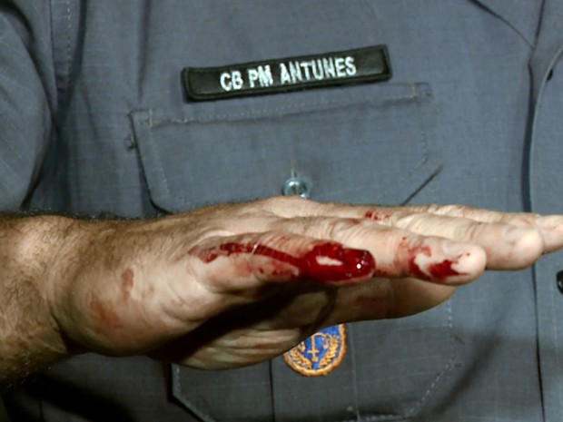 Policial mostra dedo ferido durante abordagem em Campinas (Foto: Luciano Machado/EPTV)