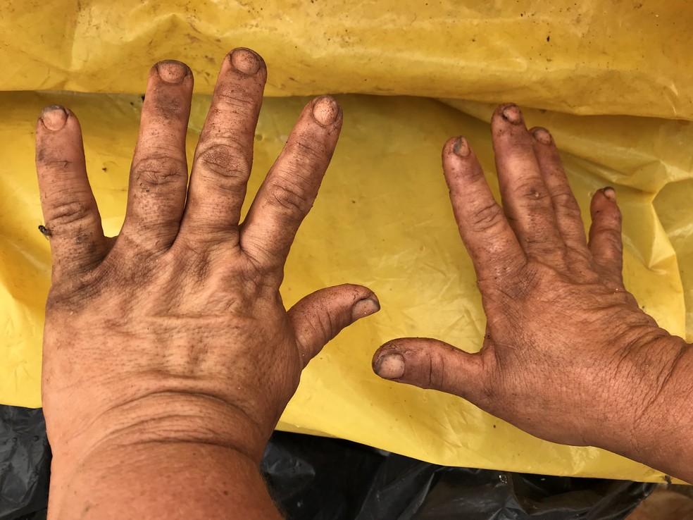 Catadora mostra mãos após um dia de trabalho no Lixão da Estrutural (Foto: Marília Marques/G1)
