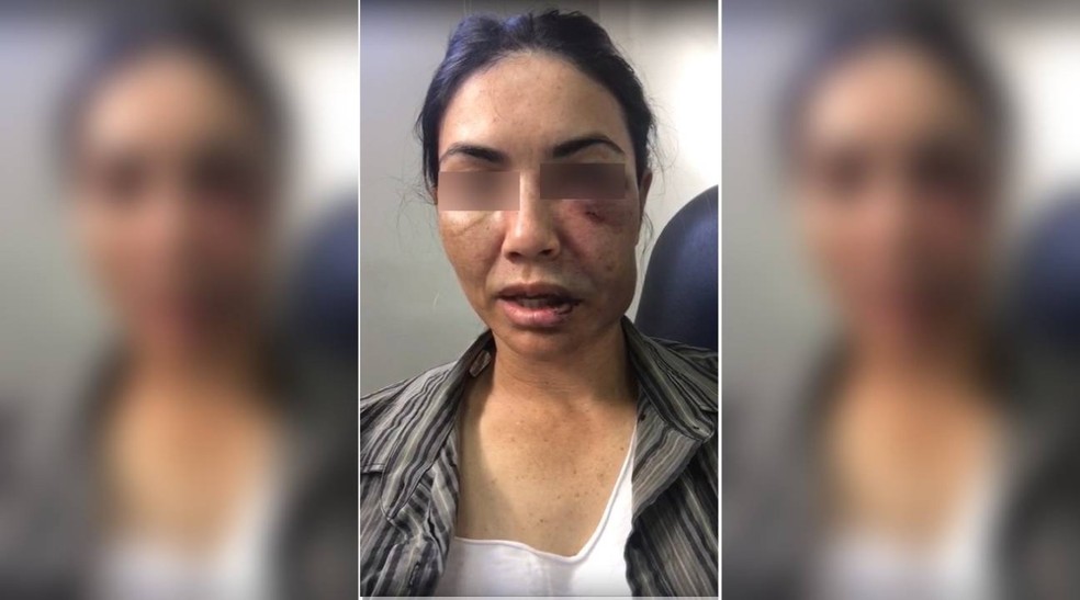 Motorista de transporte por aplicativo foi espancada por assaltantes durante uma corrida na madrugada deste sábado (24) em Tangará da Serra — Foto: Divulgação
