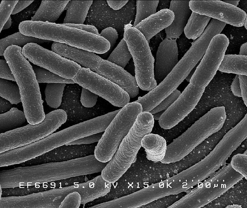 Escherichia coli, uma das muitas espécies de bactérias presentes no intestino humano. (Foto: Wikipedia Commons)