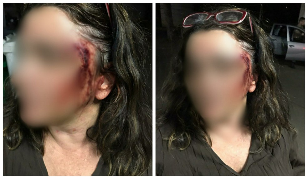 Professora é torturada por namorado durante 24 horas em bairro nobre de SP — Foto: Arquivo pessoal