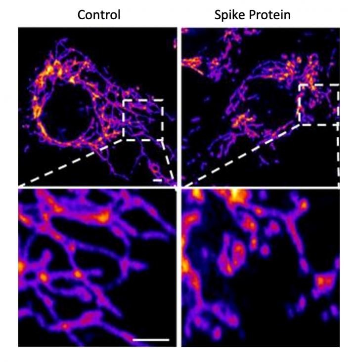 Células do  endotélio vascular (esquerda) e células tratadas com a proteína spike do Sars-CoV-2 (direita)  (Foto: Salk Institute)