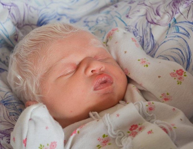 A pequena Norallyn, que nasceu albina (Foto: Reprodução/Simply B Photography)