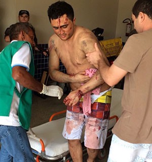 Presos feridos durante o confronto foram socorridos ao hospital da cidade (Foto: Divulgação/PM)