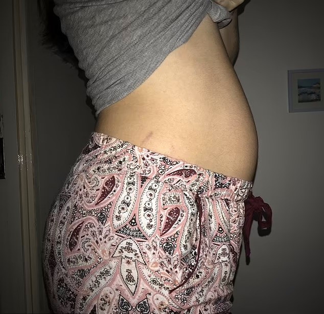 Ellie um dia antes de dar à luz. Ela acreditava que o inchaço na barriga era causado por uma obstrução (Foto: Arquivo pessoal)