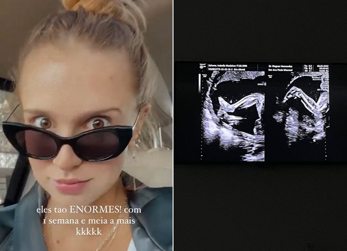 Isabella Scherer mostra ultrassom de gêmeos (Foto: Reprodução Instagram)