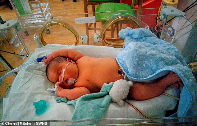 Bebê nasceu com 38 semanas (Foto: Reprodução/Daily Mail )