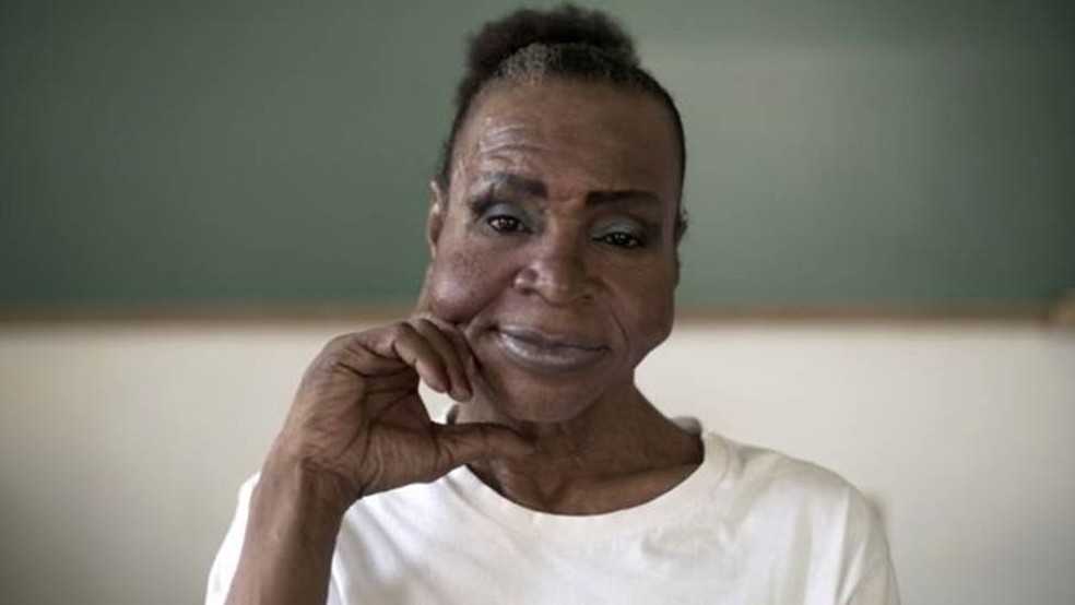 Chica disse que seu maior sonho é fazer uma cirurgia plástica no rosto para corrigir um procedimento feito no passado  — Foto: Félix Lima/BBC News Brasil