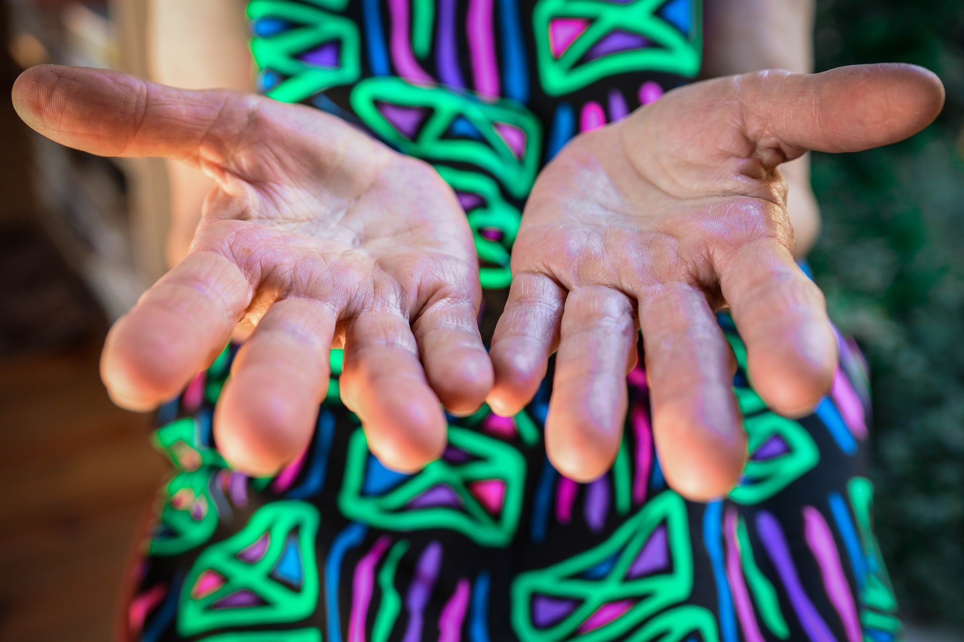 Mulher que sofreu de dores por 40 anos descobriu câncer nos dedos da mão (Foto: Claudia Love/Unsplash)