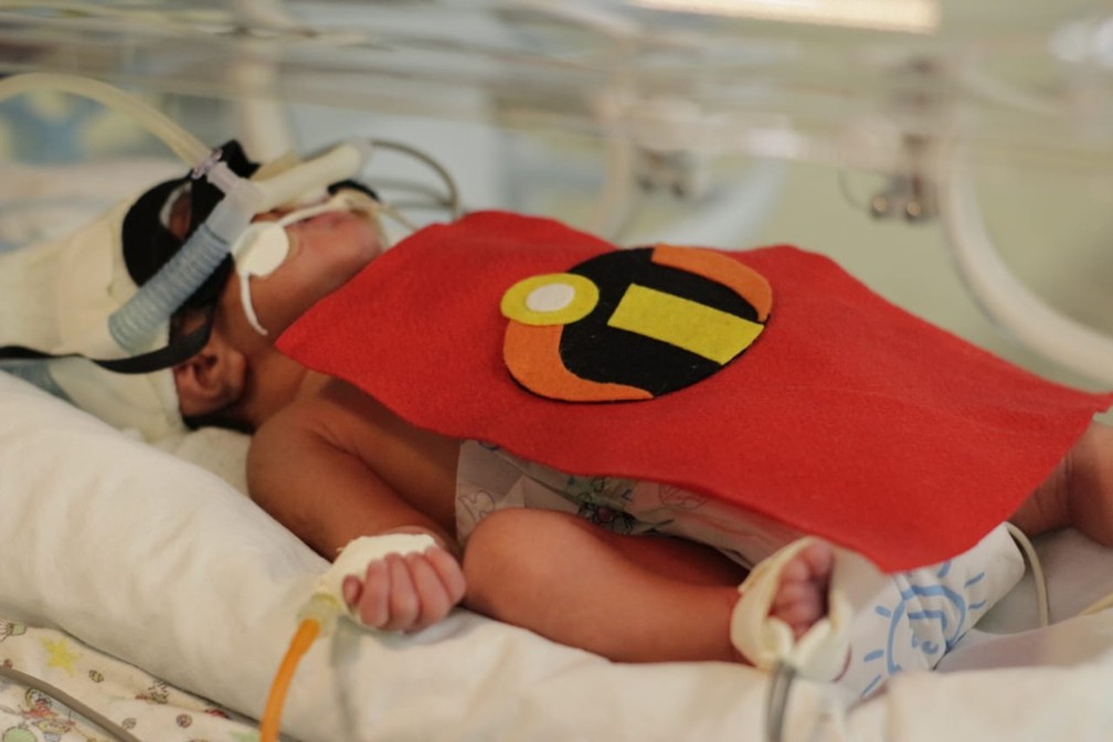 Bebês internados em UTI Neonatal ganham ensaio fotográfico inspirado no carnaval em Hospital de Floriano — Foto: Divulgação / Hospital Regional Tibério Nunes