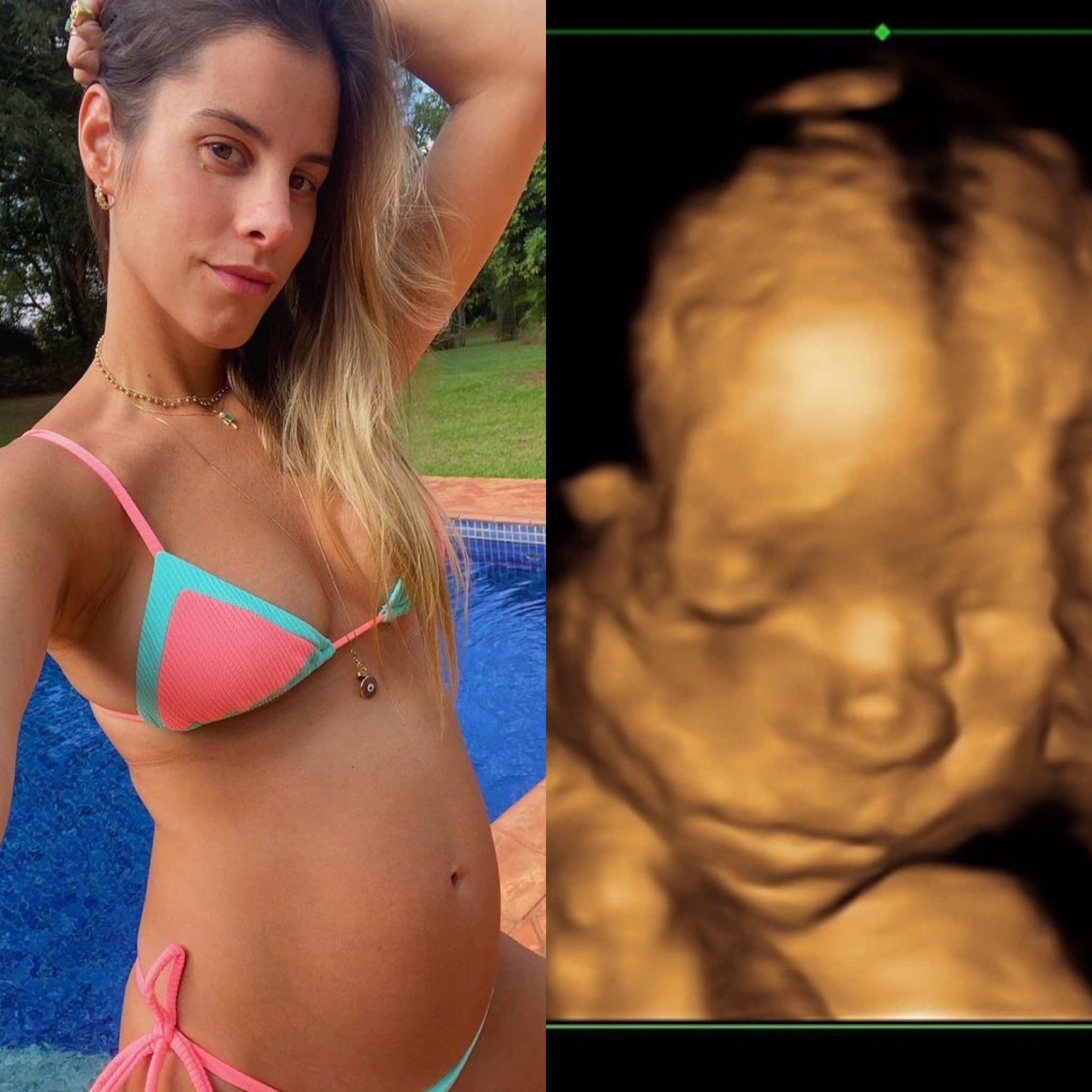 Shantal exibe rostinho do bebê na ultrassom e pergunta aos seguidores (Foto: Instagram)
