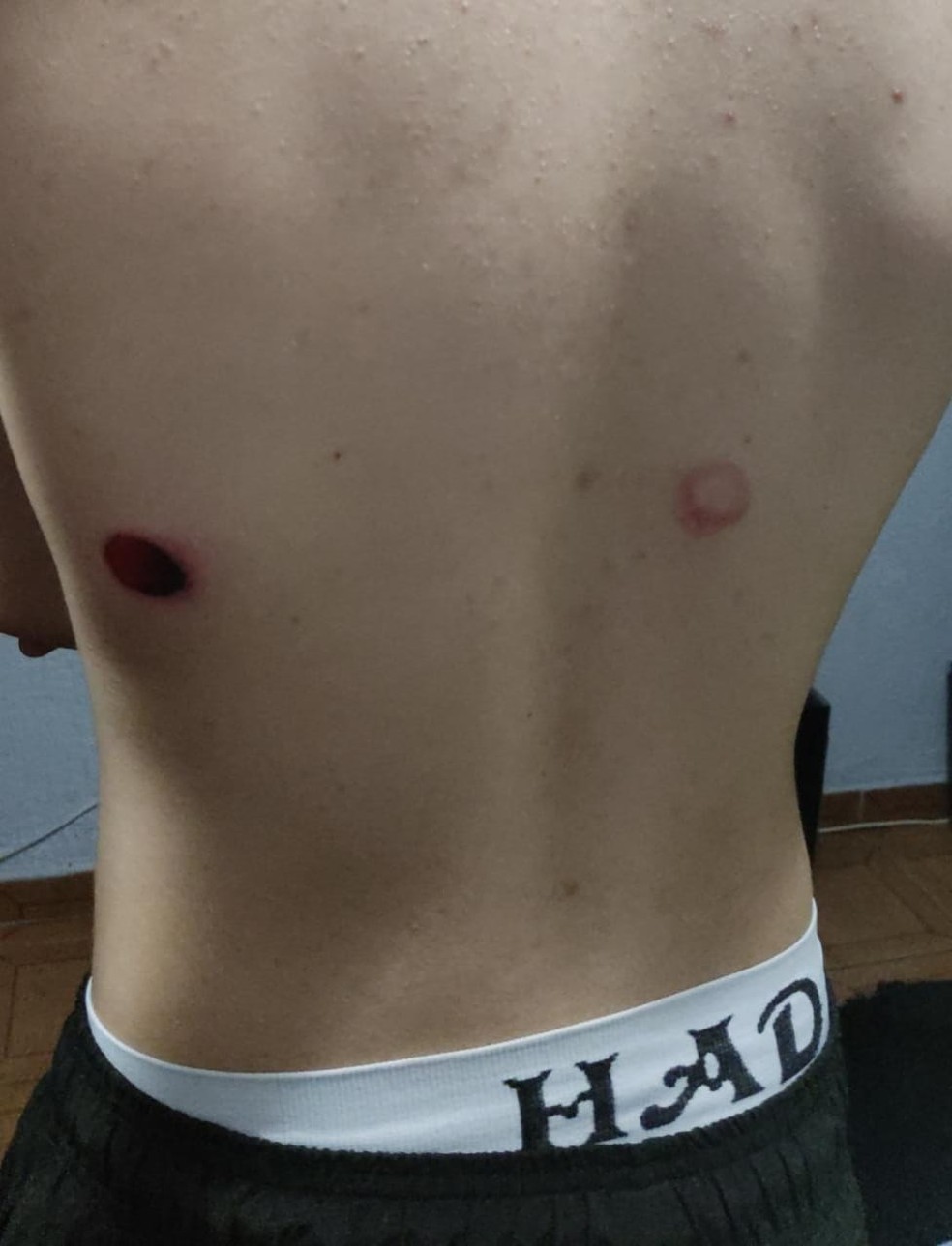 Mãe afirma que adolescente de 14 anos também foi atingido por dois tiros de borracha. — Foto: Arquivo pessoal