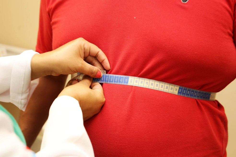 Equipes do Programa de Obesidade da Fundhacre devem operar três pessoas por semana  — Foto: Agência Pará