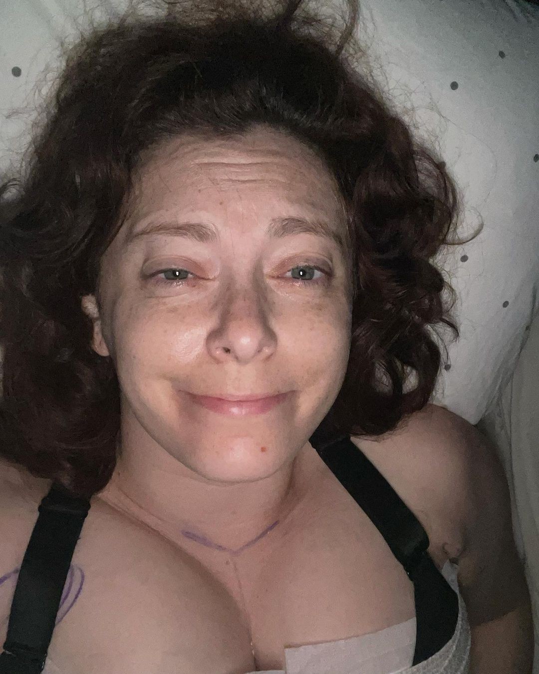 Rachel Bloom depois da cirurgia de redução de seios (Foto: Reprodução/Instagram)