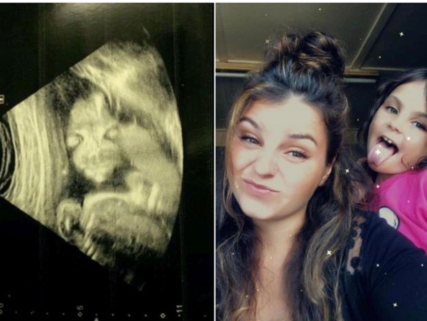 A mãe se deparou com uma imagem assustadora do bebê no ultrassom (Foto: Reprodução/ Facebook)