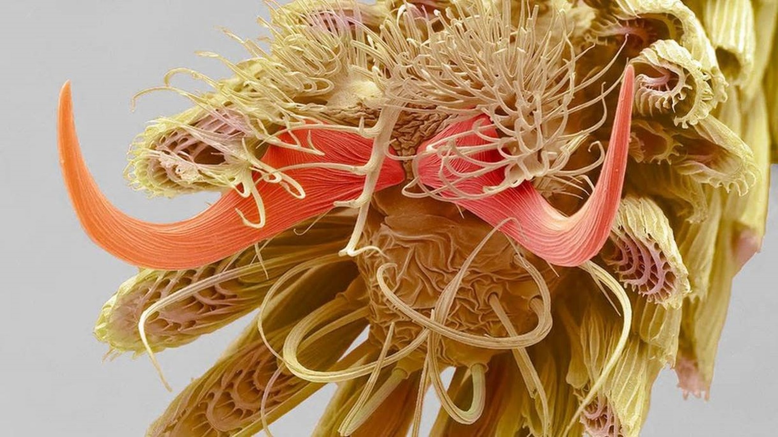 Ampliação dos filamentos presentes na ponta da pata de um mosquito (Foto: STEVE GSCHMEISSNER/Royal Photographic Society)