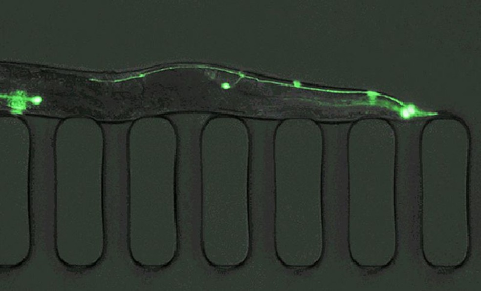 O C. elegans produz mais de 1.000 ovos por dia — eles podem ser cultivados em grande número, e culturas saudáveis ​​podem ser congeladas e depois descongeladas e revividas quando necessário — Foto: SPL via BBC